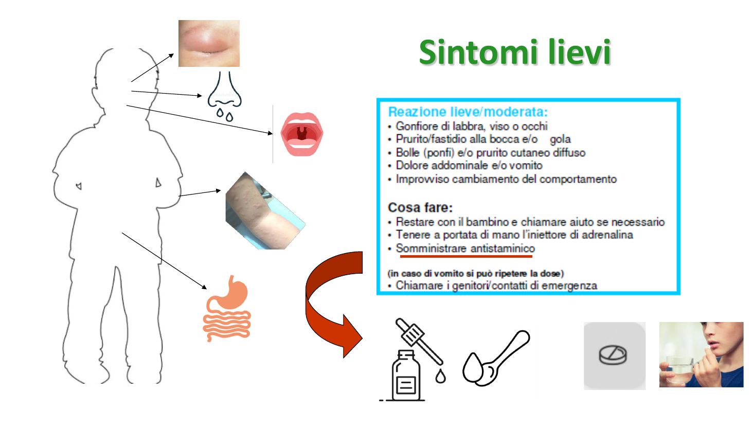 Sintomi lievi e antistaminico