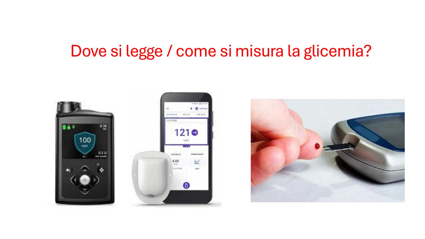 Microinfusore, sensore con telefono e glucometro